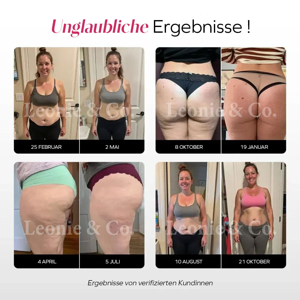 3D-Leggings | Schwarz