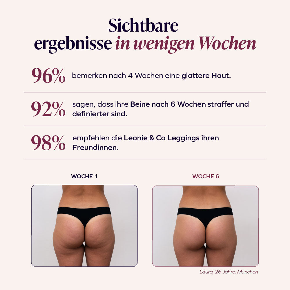 3D-Leggings | Schwarz